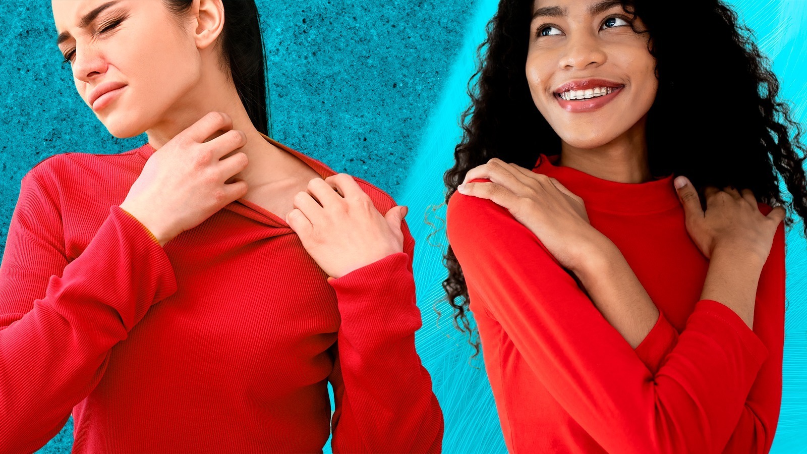 krem antyhistaminowy obok czerwonej swędzącej skóry podrażnionej swetrem